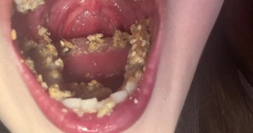 夏栖该睡啦 口腔检查 口水 饼干