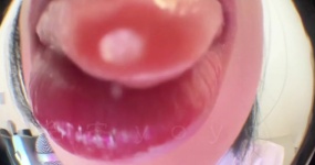 晚安yoyo  yoyo医生为你治疗（一）鱼眼