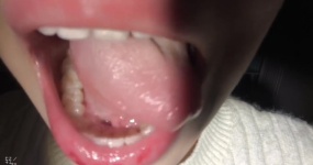 菜菜cyl不好吃 口腔检查