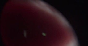 金豆雾 2026-03-12 202609